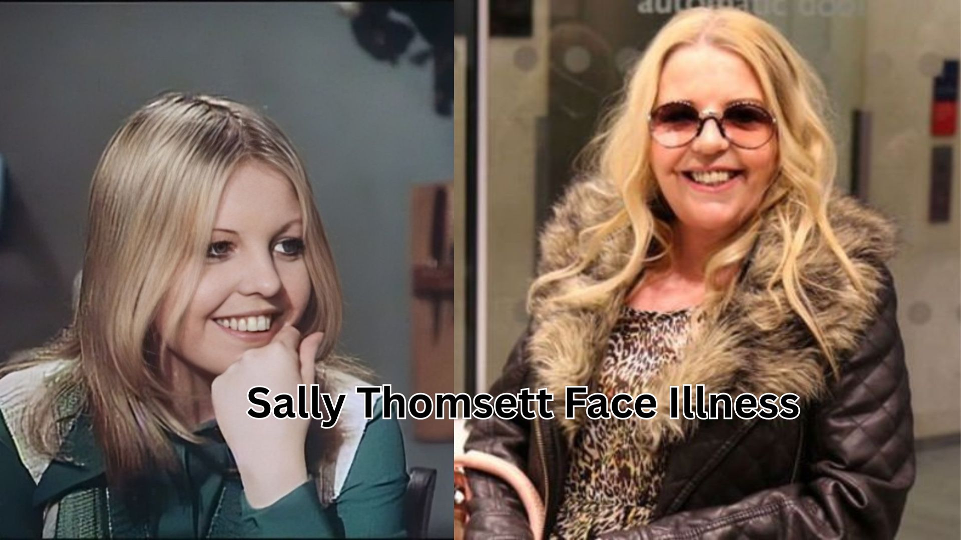 sally thomsett face illness